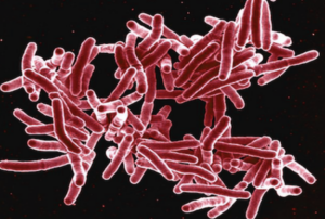 Racial, ethnic disparities persist in U.S. tuberculosis cases